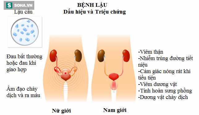 bệnh lậu