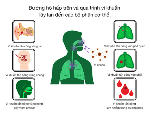 vi khuẩn hô hấp